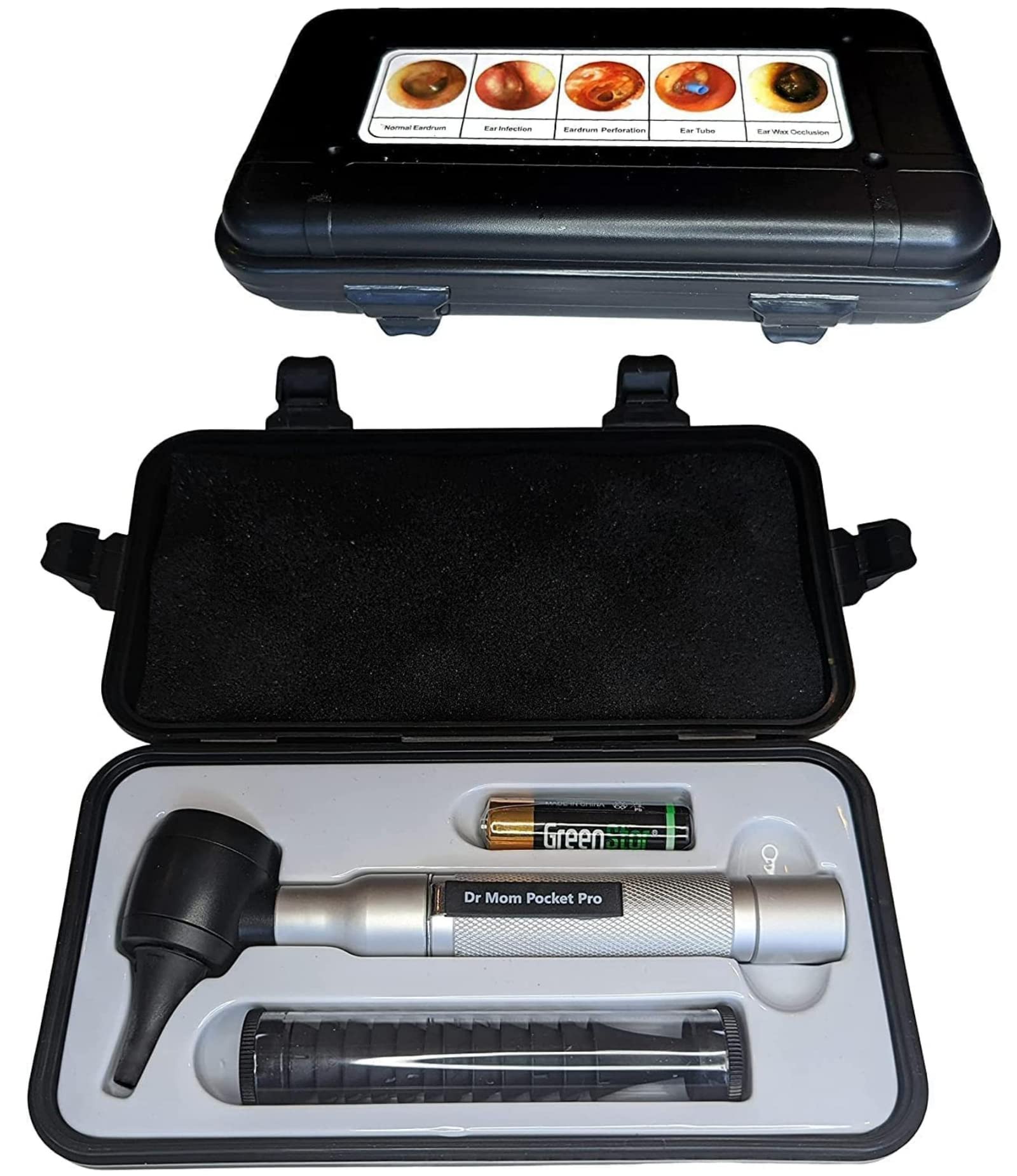 Otoscope