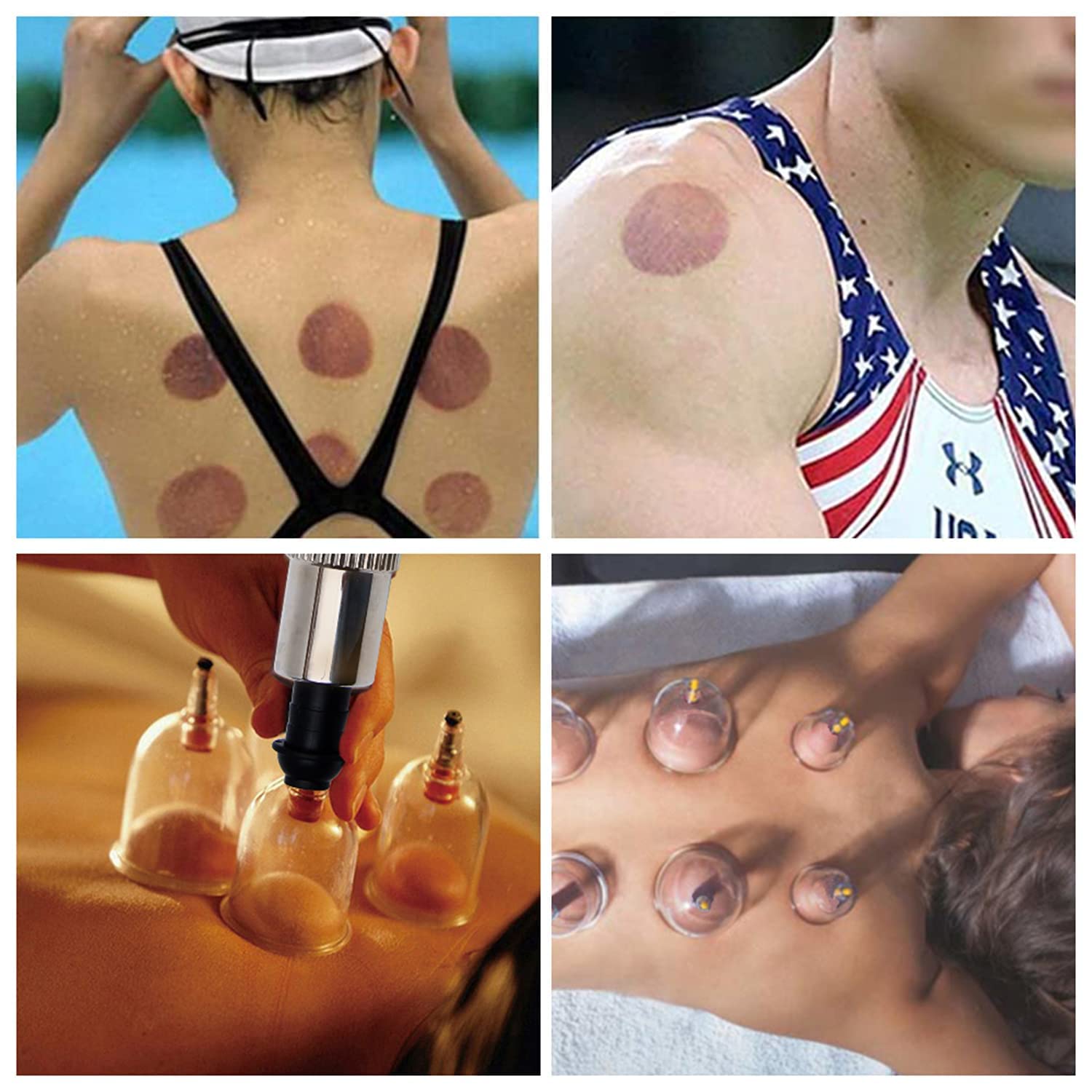 12 Therapy Cups Cupping Set with Pump