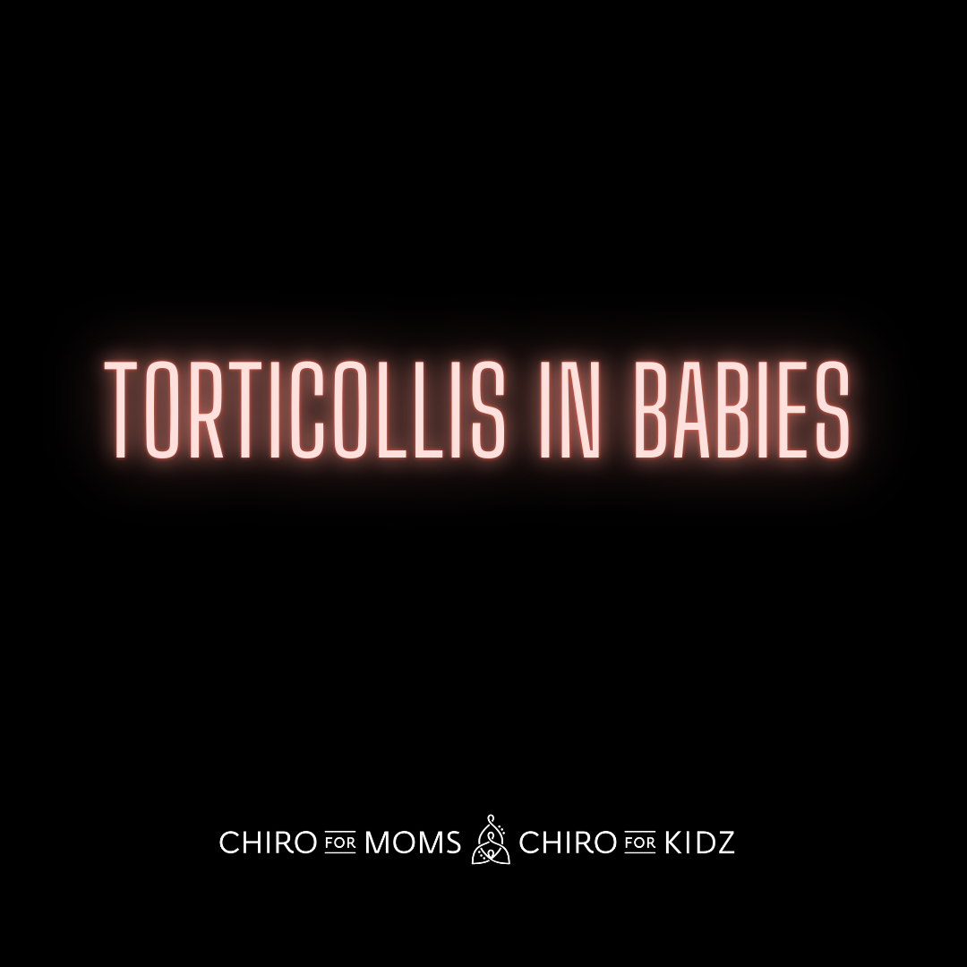 torticollis in babies
