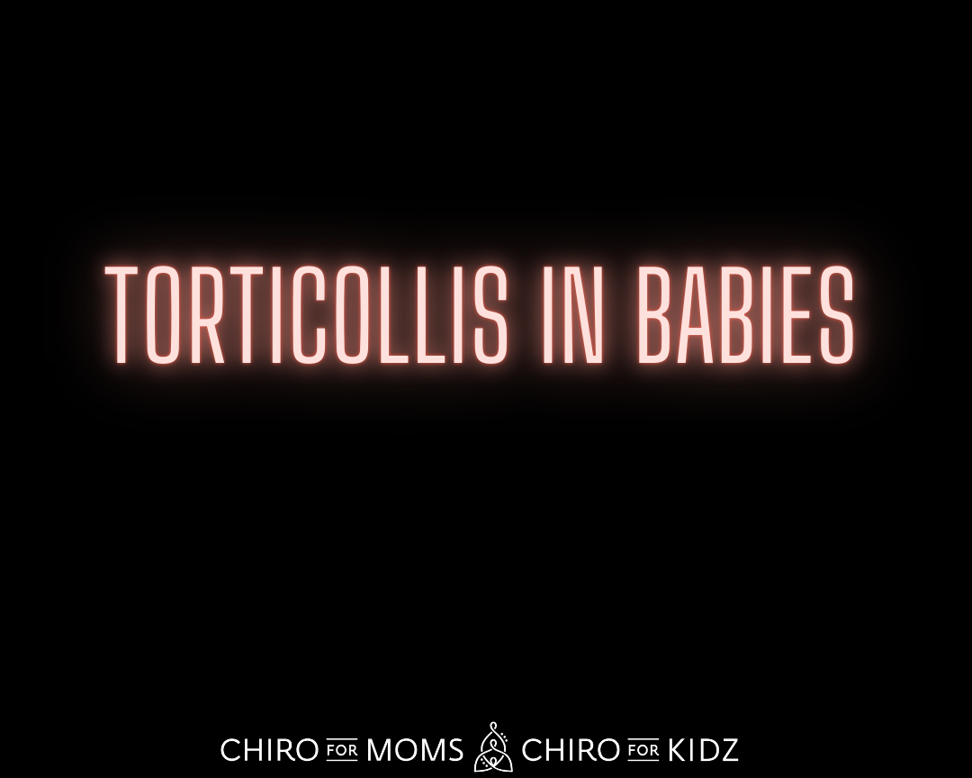 torticollis in babies